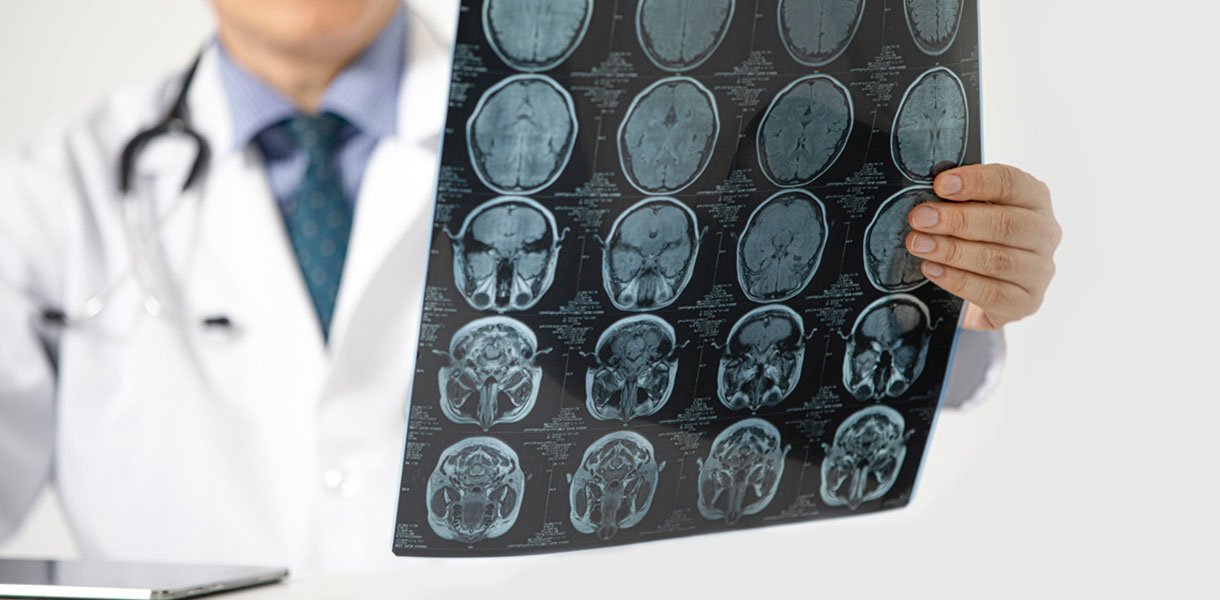 Neuro Physician Department